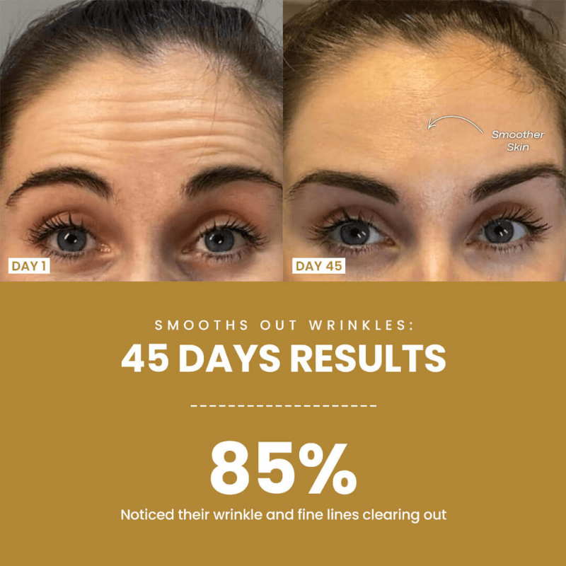 Dermaluxe LED Device