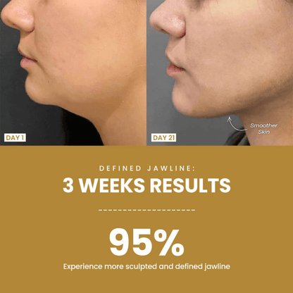 Dermaluxe LED Device