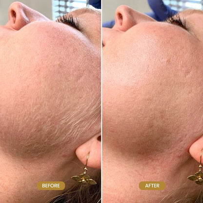 GlowBlade™ Eco friendly Dermaplane Blade